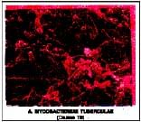 Biology, Class 9, Health and Disease, Types of Diseases, Symptoms